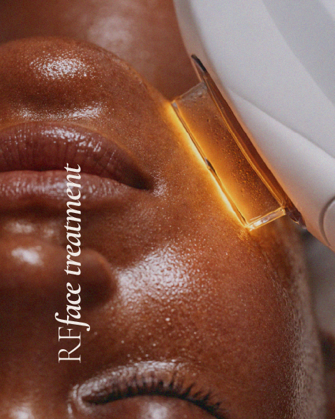 dmdfusion-bedfordview-services_RF Face Treatment