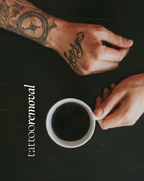 dmdfusion-bedfordview-services_Tattoo Removal